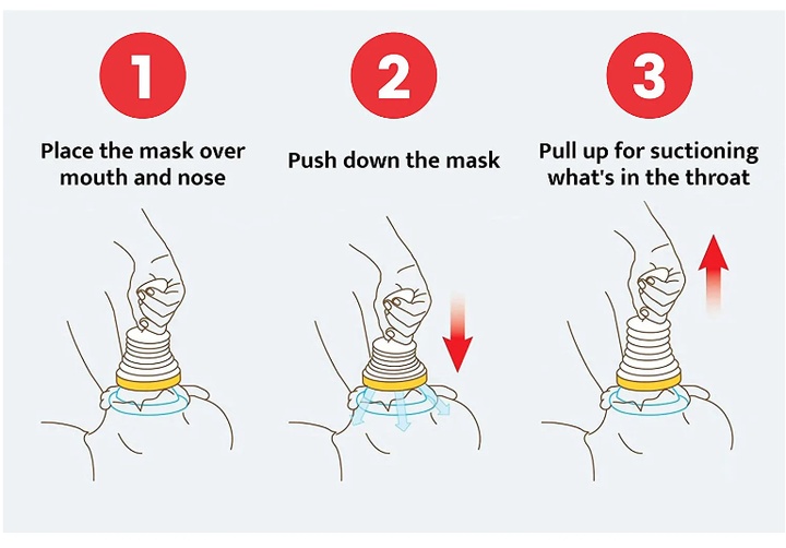 AntiChoke First Aid Choking Relief Device