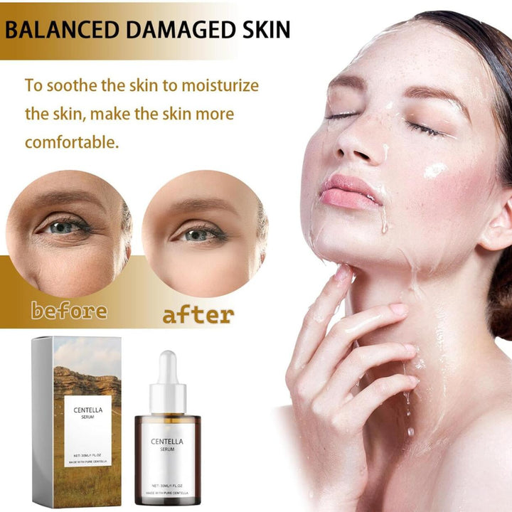 Centella Asiatica Calming Facial Serum | Redness Reduction, Hydration, and Elasticity Improvement